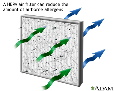 Was Ist Der Nutzen Eines HEPA-Filters?